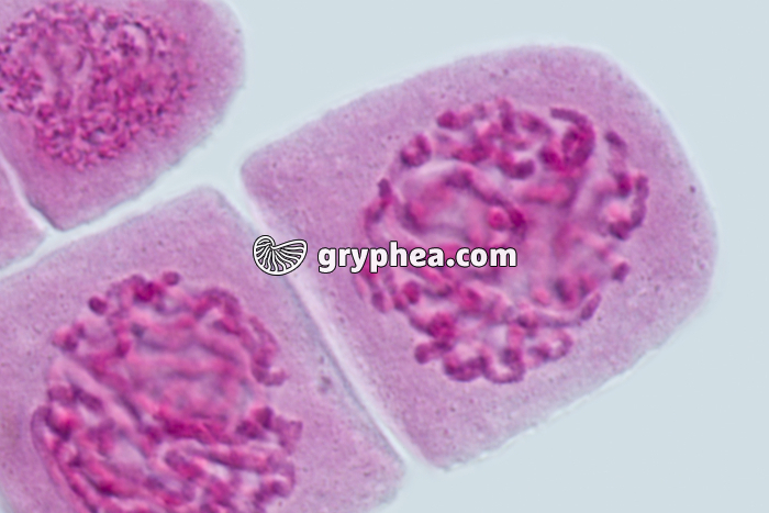 Mitose racine d'Ail DEBUT PROPHASE x640 - gryphea.com